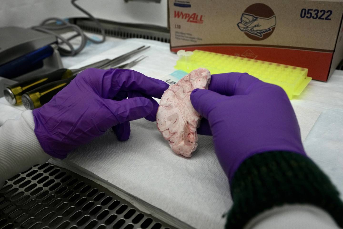 Dr. Tom Hyde, chief medical officer, takes a sample from a donated brain. The Lieber Institute for Brain Development has been working to increase diversity in research, researchers and research subjects and recently got a grant to expand efforts.