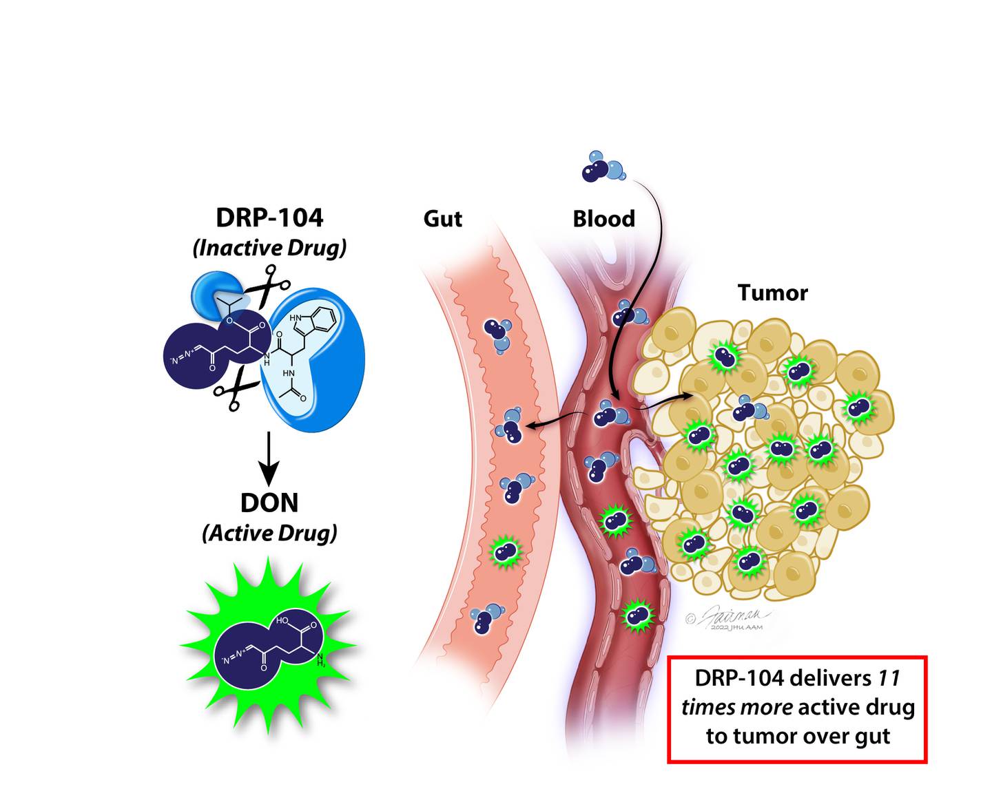 Johns Hopkins scientist modified an old cancer drug (DON) that was too toxic for the human body. Mouse studies show their new version (DRP-104) delivers 11 times more drug to the tumor than the gut, killing cancer but sparing the gut.