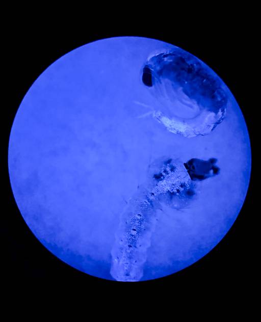 Transgenic mosquito pupa, or larvae, are shown under a microscope at the  Johns Hopkins Bloomberg School of Public Health insectary. This stage of life is akin to the chrysalis stage of a butterfly. They have a fluorescent glow to mark which pupa have been genetically modified. This protein comes from jellyfish.